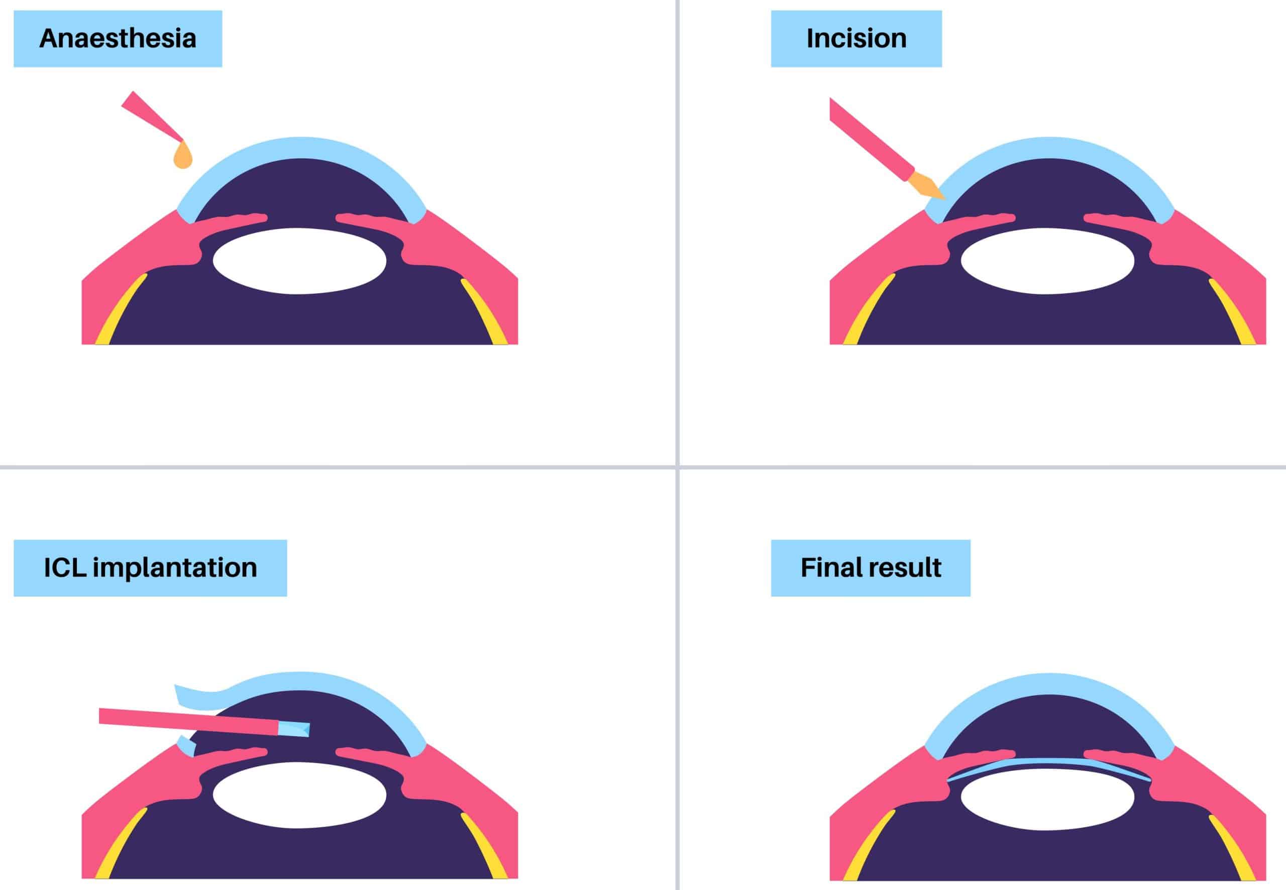 iStock 2167324279 2 scaled